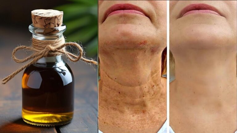 Cette astuce simple transforme votre peau en 15 jours… une jeunesse retrouvée sans Botox !