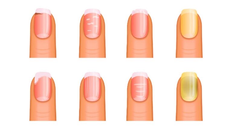 Cette astuce simple révèle ce que vos ongles disent vraiment sur votre santé…