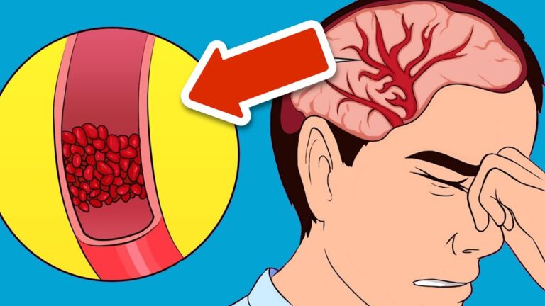 5 astuces pour soulager la migraine rapidement et facilement