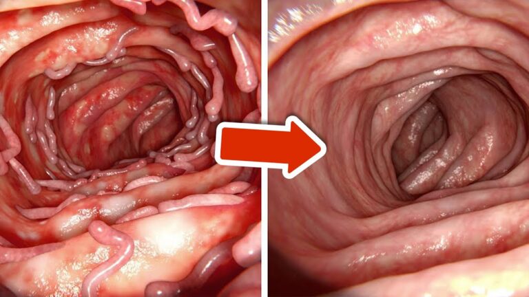 5 méthodes naturelles pour nettoyer votre gros intestin rapidement et efficacement !