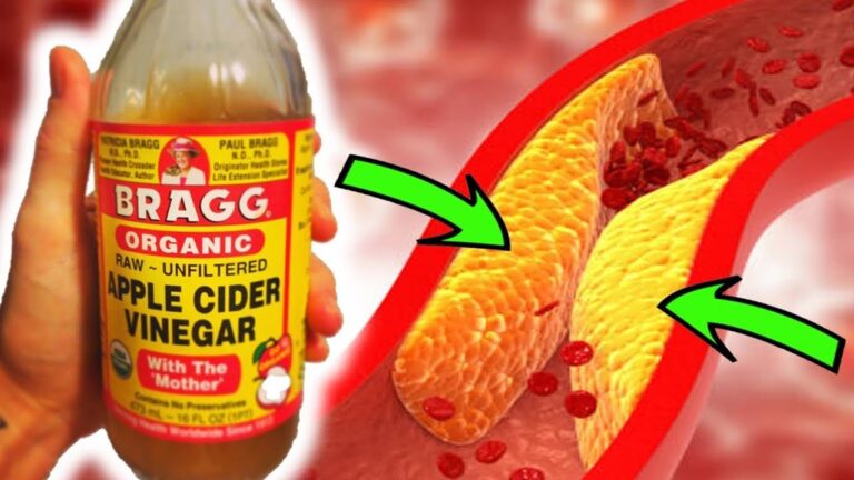 Nettoyez vos artères en 5 étapes avec du vinaigre de cidre, résultat garanti !