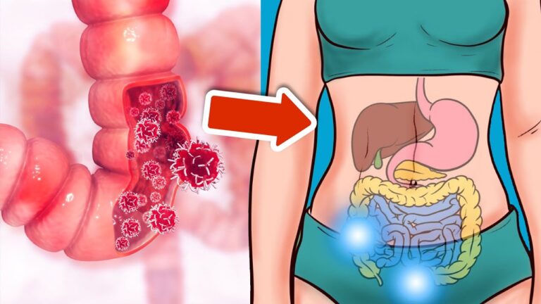 7 signes précoces de cancer colorectal à ne jamais négliger pour votre santé !