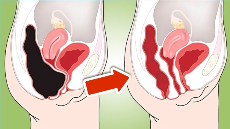 7 astuces pour une détox naturelle des intestins : découvrez des solutions surprenantes !