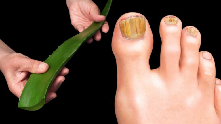 Découvrez 7 bienfaits surprenants d&rsquo;une plante miracle pour votre santé !