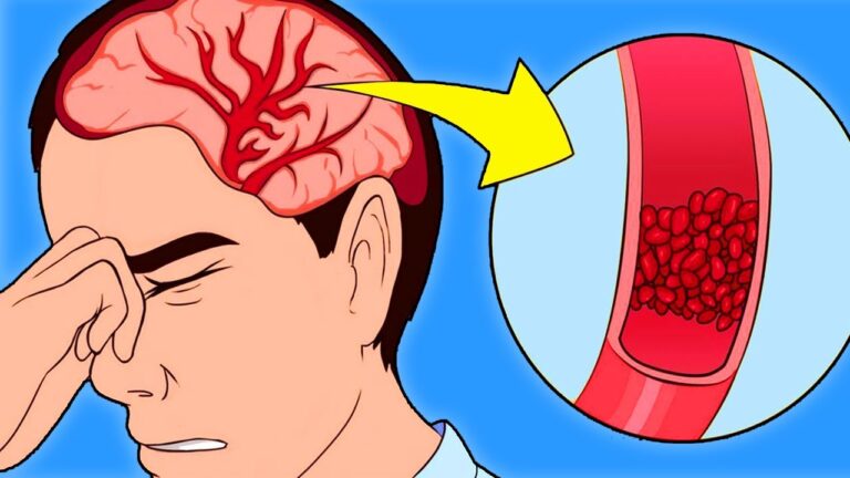 7 signes révélateurs de l&rsquo;hypertension à ne pas ignorer immédiatement !